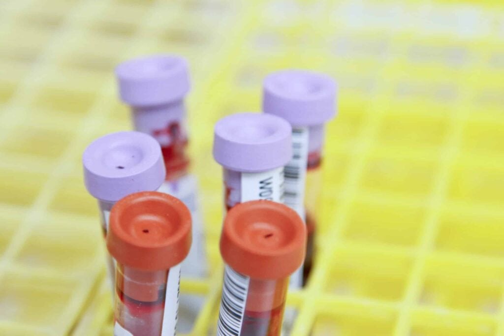 AMH testing – what’ s it for?