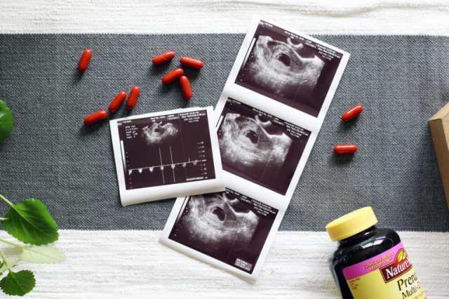 When Should I Start Prenatal Vitamins Fertility 2 Family