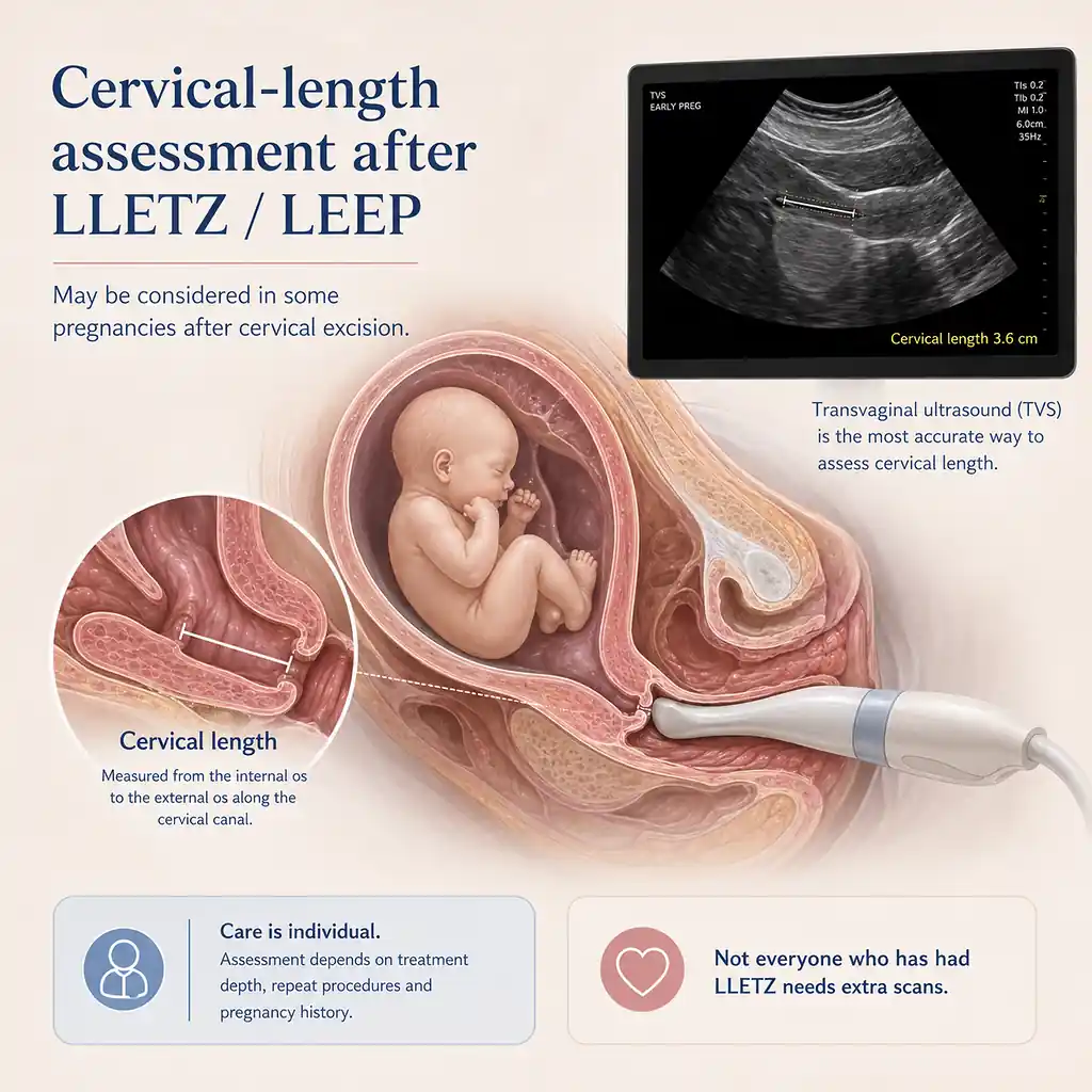 Transvaginal cervical-length ultrasound measurement during pregnancy after previous LLETZ treatment