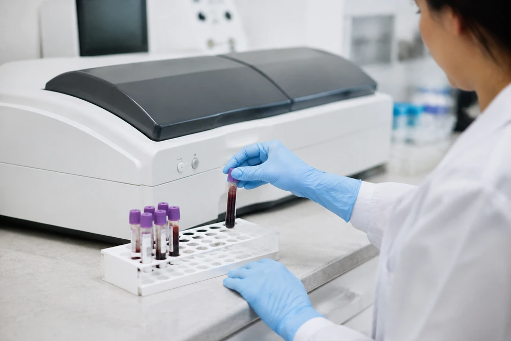 AMH blood test context for low ovarian reserve and fertility assessment in Australia